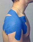Kinesio Tape Schulter - Heilpraktiker Peter Rocholl