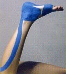 Kinesio Tape Fuß - Heilpraktiker Peter Rocholl